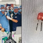 Indian Army Doctors in Pune Save 9-Month-Old Baby After Removing LED Bulb from Lung