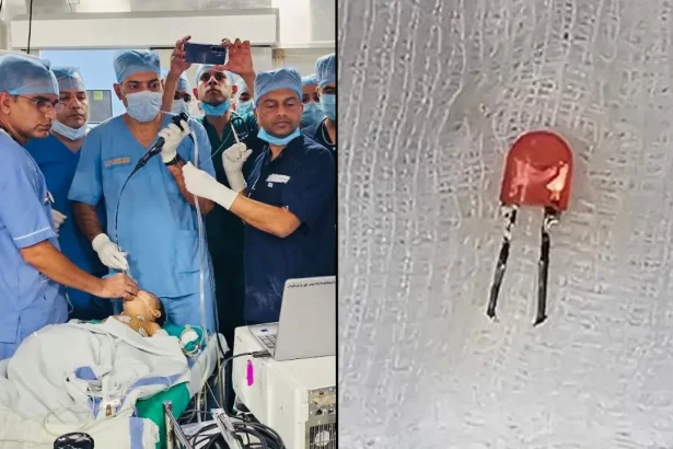 Indian Army Doctors in Pune Save 9-Month-Old Baby After Removing LED Bulb from Lung