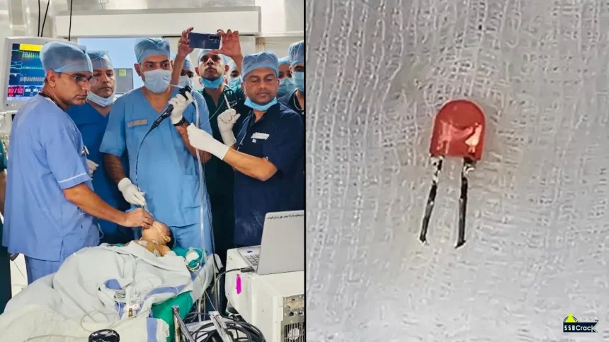 Indian Army Doctors in Pune Save 9-Month-Old Baby After Removing LED Bulb from Lung